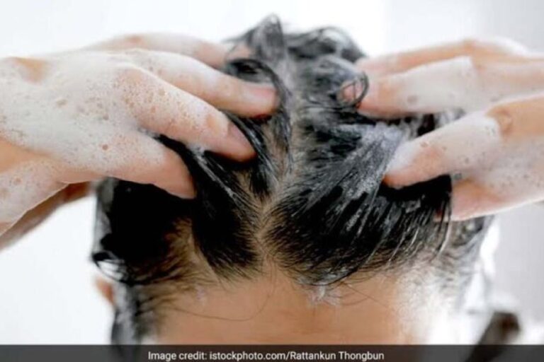 शैम्पू-बदलने-से-नहीं-रुकता-हेयर-फॉल?-जानिए-बाल-झड़ने-की-असली-वजह